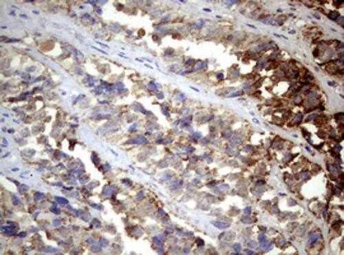 Immunohistochemistry:PI 3-Kinase p110 delta Antibody (OTI1D11) - Azide and BSA Free[NBP2-73396]