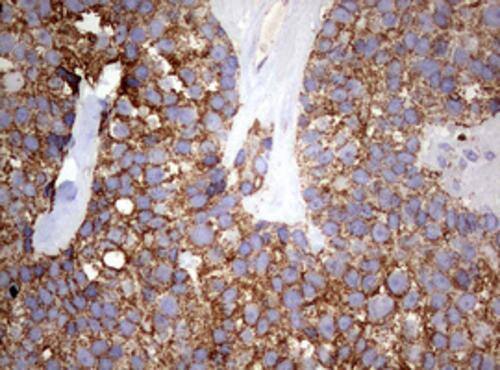 Immunohistochemistry:PI 3-Kinase p110 delta Antibody (OTI1D11) - Azide and BSA Free[NBP2-73396]
