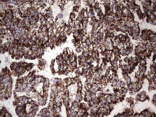 Immunohistochemistry:PI 3-Kinase p110 delta Antibody (OTI1D11) - Azide and BSA Free[NBP2-73396]
