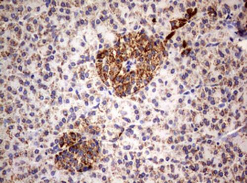 Immunohistochemistry:PI 3-Kinase p110 delta Antibody (OTI1D11) - Azide and BSA Free[NBP2-73396]