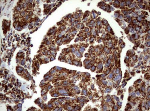 Immunohistochemistry:PI 3-Kinase p110 delta Antibody (OTI1D11) - Azide and BSA Free[NBP2-73396]