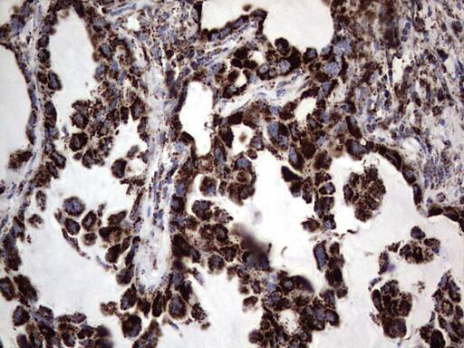 Immunohistochemistry:PI 3-Kinase p110 delta Antibody (OTI1D11) - Azide and BSA Free[NBP2-73396]