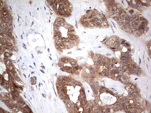 Immunohistochemistry:PIK3CA Antibody (OTI6D9) - Azide and BSA Free[NBP2-73406]