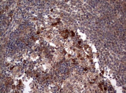 Immunohistochemistry:PIK3CA Antibody (OTI6D9) - Azide and BSA Free[NBP2-73406]