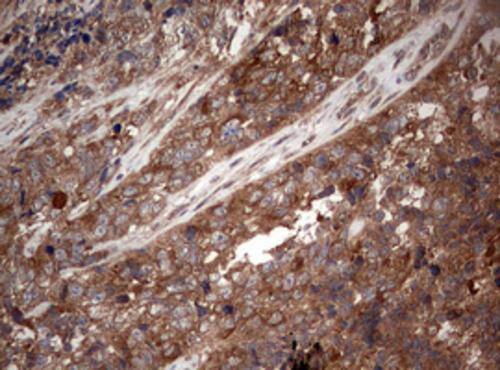 Immunohistochemistry:PIK3CA Antibody (OTI6D9) - Azide and BSA Free[NBP2-73406]