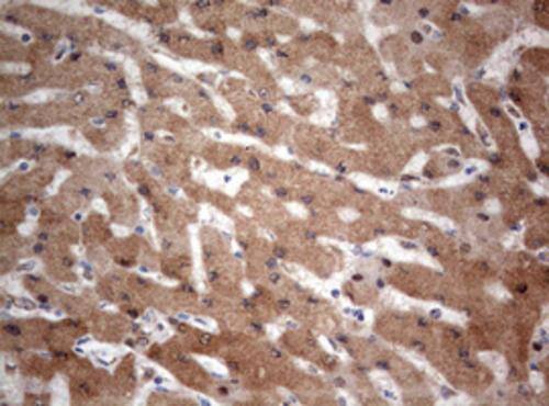 Immunohistochemistry:PIK3CA Antibody (OTI6D9) - Azide and BSA Free[NBP2-73406]