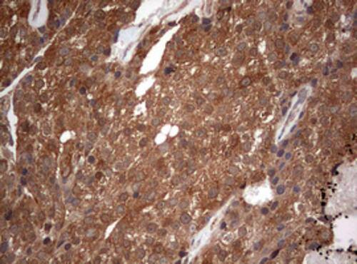 Immunohistochemistry:PIK3CA Antibody (OTI6D9) - Azide and BSA Free[NBP2-73406]