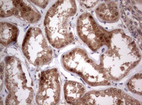 Immunohistochemistry:PIK3CA Antibody (OTI6D9) - Azide and BSA Free[NBP2-73406]