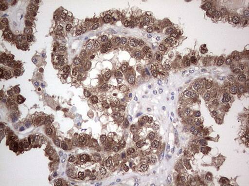 Immunohistochemistry:PIK3CA Antibody (OTI6D9) - Azide and BSA Free[NBP2-73406]
