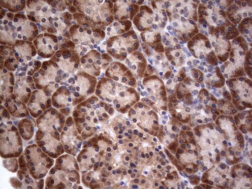 Immunohistochemistry:PIK3CA Antibody (OTI6D9) - Azide and BSA Free[NBP2-73406]