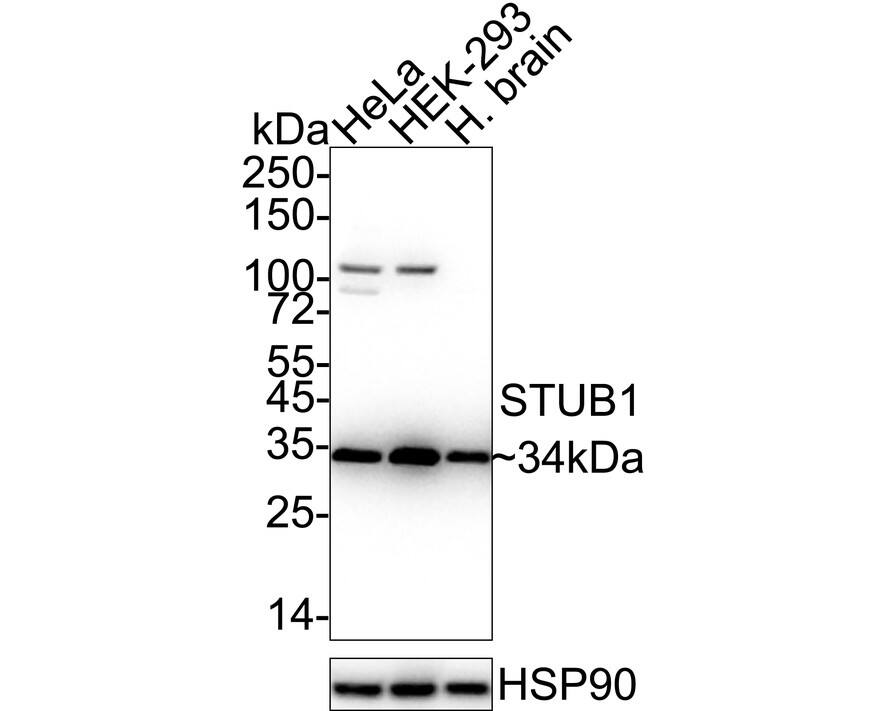 Western blot analysis on different lysates with NBP2-75440 at 1/1,000 dilution. Lane 1: HeLa cell lysate (15 µg/Lane) Lane 2: HEK-293 cell lysate (15 µg/Lane) Lane 3: Human brain tissue lysate (30 µg/Lane) Predicted band size: 35 kDa Observed band size: 34 kDa Exposure time: 14 seconds;  4-20% SDS-PAGE gel. Proteins were transferred to a PVDF membrane and blocked with 5% NFDM/TBST for 1 hour at room temperature. NBP2-75440 at 1/1,000 dilution was used in 5% NFDM/TBST at 4℃ overnight. Goat Anti-Rabbit IgG [HRP] Secondary Antibody at 1/50,000 dilution was used for 1 hour at room temperature.