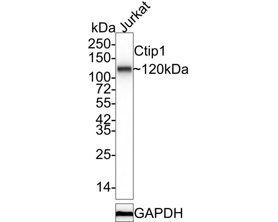 Western blot analysis of  Jurkat cell lysates with NBP2-75455 at 1/5,000 dilution. Lysates/proteins at 20 µg/Lane. Predicted band size: 91 kDa Observed band size: 120 kDa Exposure time: 3 minutes;  4-20% SDS-PAGE gel. Proteins were transferred to a PVDF membrane and blocked with 5% NFDM/TBST for 1 hour at room temperature. NBP2-75455 at 1/5,000 dilution was used in 5% NFDM/TBST at 4℃ overnight. Goat Anti-Rabbit IgG [HRP] Secondary Antibody at 1/50,000 dilution was used for 1 hour at room temperature.