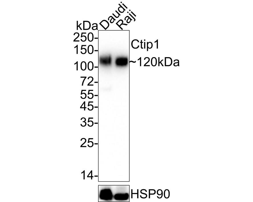 Western blot analysis on different lysates with NBP2-75455 at 1/1,000 dilution. Lane 1: Daudi cell lysate Lane 2: Raji cell lysate Lysates/proteins at 20 µg/Lane. Predicted band size: 91 kDa Observed band size: 120 kDa Exposure time: 20 seconds;  4-20% SDS-PAGE gel. Proteins were transferred to a PVDF membrane and blocked with 5% NFDM/TBST for 1 hour at room temperature. NBP2-75455 at 1/1,000 dilution was used in 5% NFDM/TBST at 4℃ overnight. Goat Anti-Rabbit IgG [HRP] Secondary Antibody at 1/50,000 dilution was used for 1 hour at room temperature.