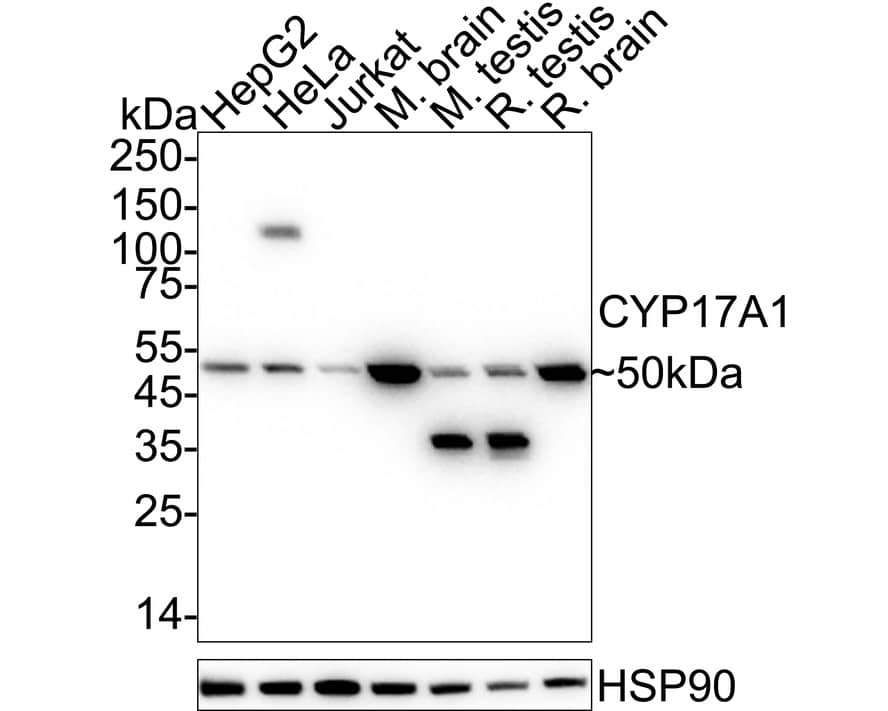 Western blot analysis on different lysates with NBP2-75461 at 1/1,000 dilution. Lane 1: HepG2 cell lysate (20 µg/Lane) Lane 2: HeLa cell lysate (20 µg/Lane) Lane 3: Jurkat cell lysate (20 µg/Lane) Lane 4: Mouse brain tissue lysate (40 µg/Lane) Lane 5: Mouse testis tissue lysate (40 µg/Lane) Lane 6: Rat testis tissue lysate (40 µg/Lane) Lane 7: Rat brain tissue lysate (40 µg/Lane) Predicted band size: 57 kDa Observed band size: 50 kDa Exposure time: 20 seconds;  4-20% SDS-PAGE gel. Proteins were transferred to a PVDF membrane and blocked with 5% NFDM/TBST for 1 hour at room temperature. NBP2-75461 at 1/1,000 dilution was used in 5% NFDM/TBST at 4℃ overnight. Goat Anti-Rabbit IgG [HRP] Secondary Antibody at 1/50,000 dilution was used for 1 hour at room temperature.