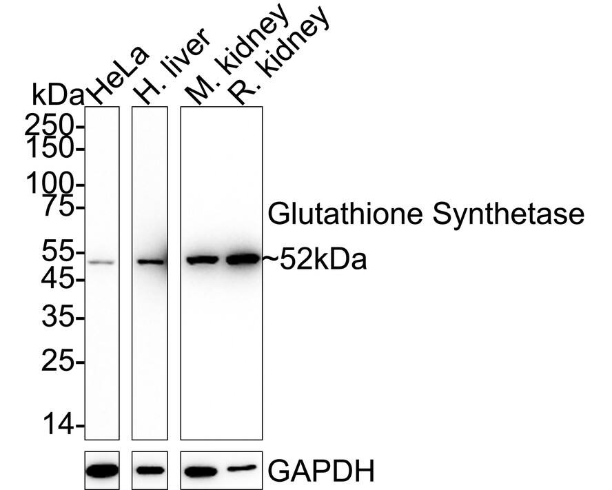 Western blot analysis on different lysates with NBP2-75513 at 1/1,000 dilution. Lane 1: HeLa cell lysate Lane 2: Human liver tissue lysate Lane 3: Mouse kidney tissue lysate Lane 4: Rat kidney tissue lysate Lysates/proteins at 20 µg/Lane. Predicted band size: 52 kDa Observed band size: 52 kDa Exposure time: Lane 1-2: 3 minutes; Lane 3-4: 30 seconds;  4-20% SDS-PAGE gel. Proteins were transferred to a PVDF membrane and blocked with 5% NFDM/TBST for 1 hour at room temperature. NBP2-75513 at 1/1,000 dilution was used in 5% NFDM/TBST at 4℃ overnight. Goat Anti-Rabbit IgG [HRP] Secondary Antibody at 1/50,000 dilution was used for 1 hour at room temperature.