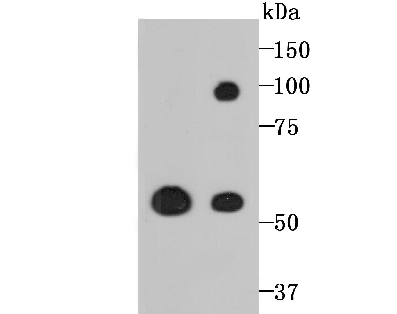 Western blot analysis on different lysates with NBP2-75559 at 1/500 dilution. Lane 1: PC-12 cell lysate, 10 µg/Lane Lane 2: A549 cell lysate, 10 µg/Lane Predicted band size: 87 kDa Observed band size: 59 kDa Exposure time: 2 minutes; 10% SDS-PAGE gel. Proteins were transferred to a PVDF membrane and blocked with 5% NFDM/TBST for 1 hour at room temperature. NBP2-75559 at 1/500 dilution was used in 5% NFDM/TBST at room temperature for 2 hours. Goat Anti-Rabbit IgG [HRP] Secondary Antibody at 1:200,000 dilution was used for 1 hour at room temperature.