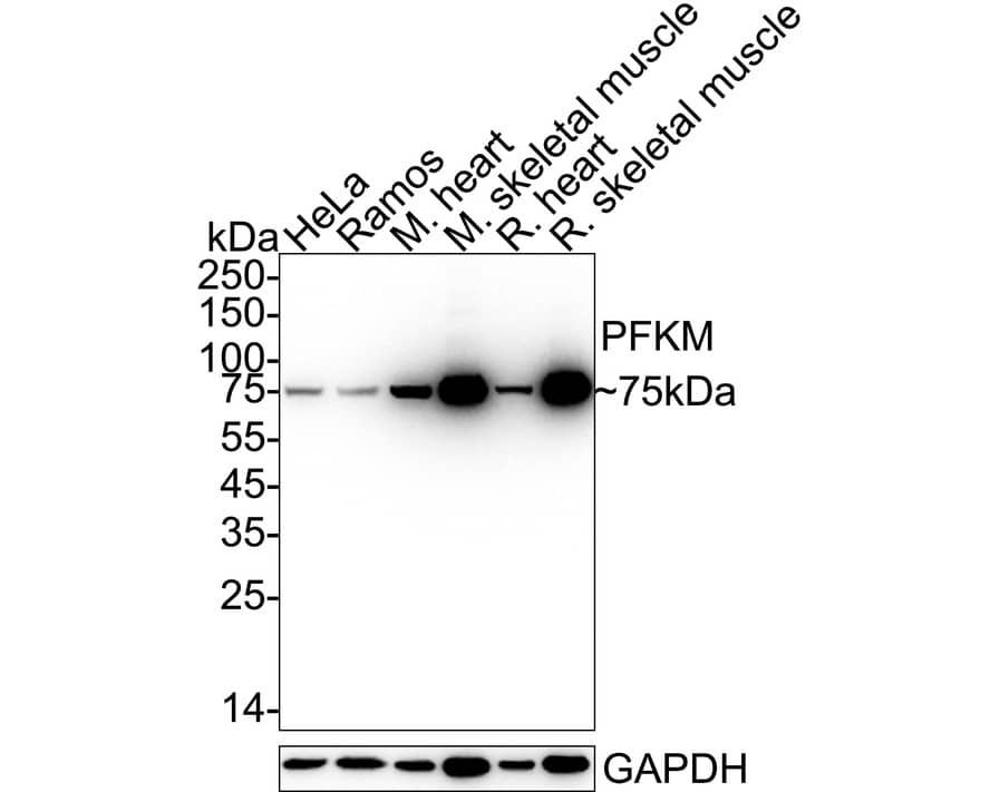 Western blot analysis on different lysates with NBP2-75578 at 1/1,000 dilution. Lane 1: HeLa cell lysate Lane 2: Ramos cell lysate Lane 3: Mouse heart tissue lysate Lane 4: Mouse skeletal muscle tissue lysate Lane 5: Rat heart tissue lysate Lane 6: Rat skeletal muscle tissue lysate Lysates/proteins at 20 µg/Lane. Predicted band size: 85 kDa Observed band size: 75 kDa Exposure time: 10 seconds;  4-20% SDS-PAGE gel. Proteins were transferred to a PVDF membrane and blocked with 5% NFDM/TBST for 1 hour at room temperature. NBP2-75578 at 1/1,000 dilution was used in 5% NFDM/TBST at 4℃ overnight. Goat Anti-Rabbit IgG [HRP] Secondary Antibody at 1/50,000 dilution was used for 1 hour at room temperature.