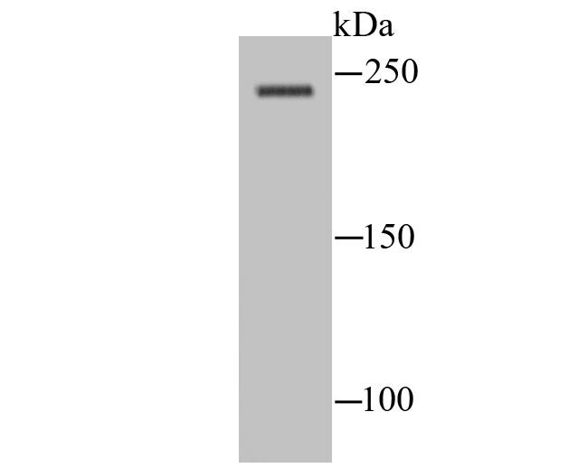 Western blot analysis of NaV1.8 on rat spinal cord lysate using anti-NaV1.8 antibody at 1/100 dilution.