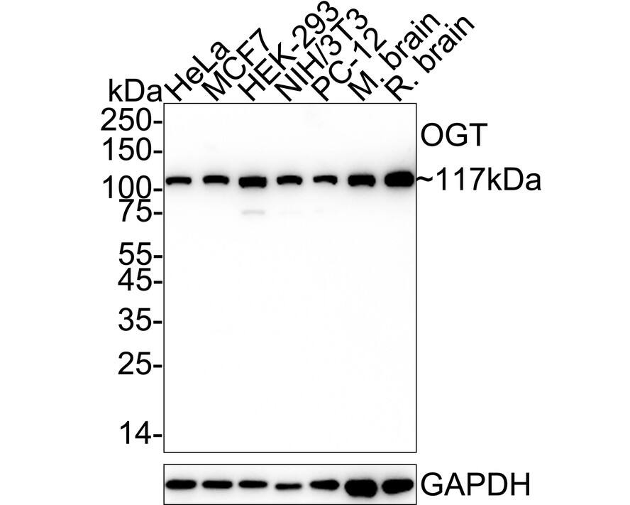 Western blot analysis on different lysates with NBP2-75601 at 1/2,000 dilution. Lane 1: HeLa cell lysate (20 µg/Lane) Lane 2: MCF7 cell lysate (20 µg/Lane) Lane 3: HEK-293 cell lysate (20 µg/Lane) Lane 4: NIH/3T3 cell lysate (20 µg/Lane) Lane 5: PC-12 cell lysate (20 µg/Lane) Lane 6: Mouse brain tissue lysate (40 µg/Lane) Lane 7: Rat brain tissue lysate (40 µg/Lane) Predicted band size: 117 kDa Observed band size: 117kDa Exposure time: 46 seconds;  4-20% SDS-PAGE gel. Proteins were transferred to a PVDF membrane and blocked with 5% NFDM/TBST for 1 hour at room temperature. NBP2-75601 at 1/2,000 dilution was used in 5% NFDM/TBST at 4℃ overnight. Goat Anti-Rabbit IgG [HRP] Secondary Antibody at 1/50,000 dilution was used for 1 hour at room temperature.