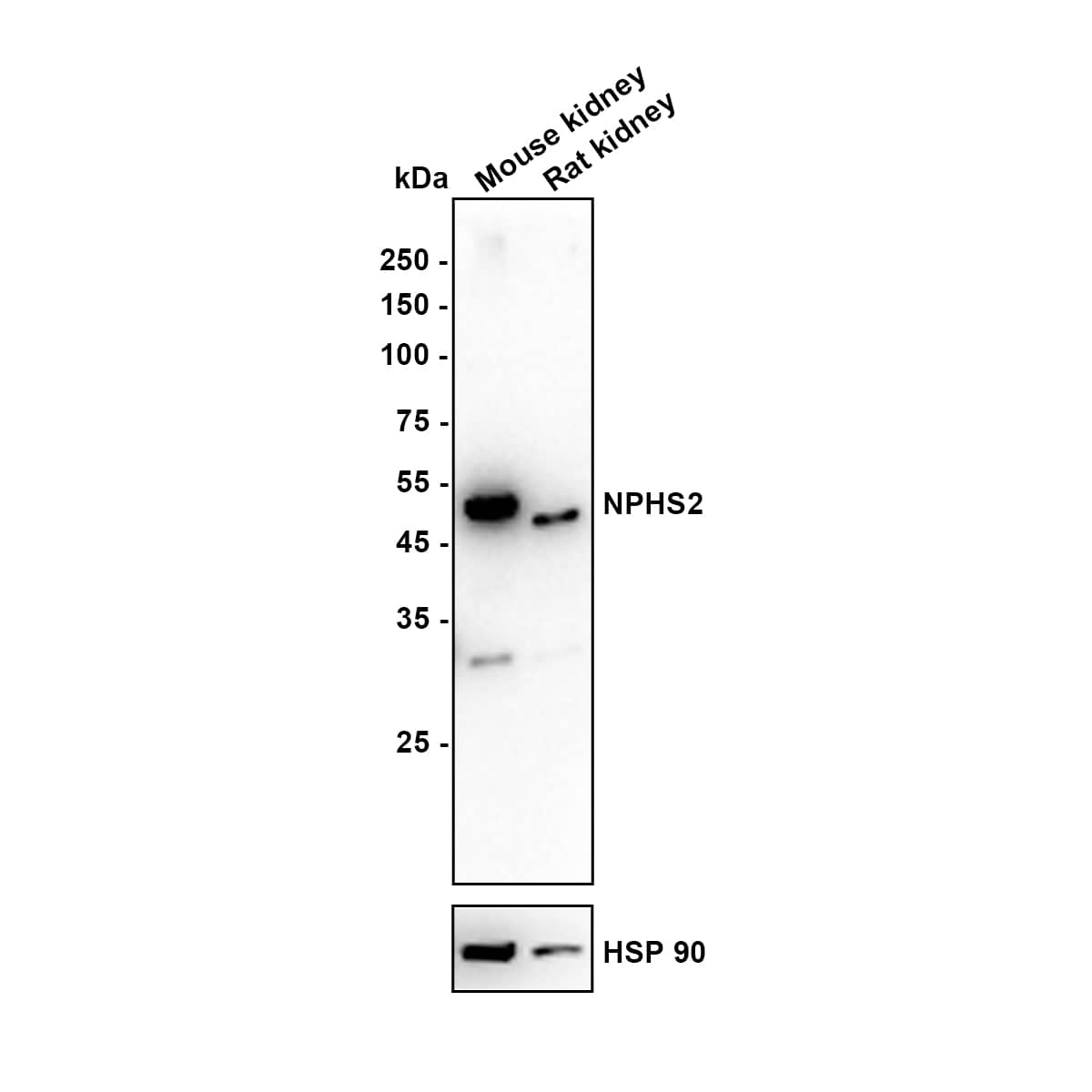 Western blot analysis on different lysates with NBP2-75624 at 1/1,000 dilution. Lane 1: Mouse kidney tissue lysate Lane 2: Rat kidney tissue lysate Lysates/proteins at 20 µg/Lane. Exposure time: 2 minutes Blocking: 5% NFDM/TBST, 1 hour at room temperature Primary antibody: NBP2-75624, 1/1,000 in 5% NFDM/TBST, overnight at 4 ℃ Secondary antibody: Goat Anti-Rabbit IgG [HRP] Secondary Antibody, 1/50,000 in 5% NFDM/TBST, 1 hour at room temperature Predicted band size: 42 kDa Observed band size: 50 kDa