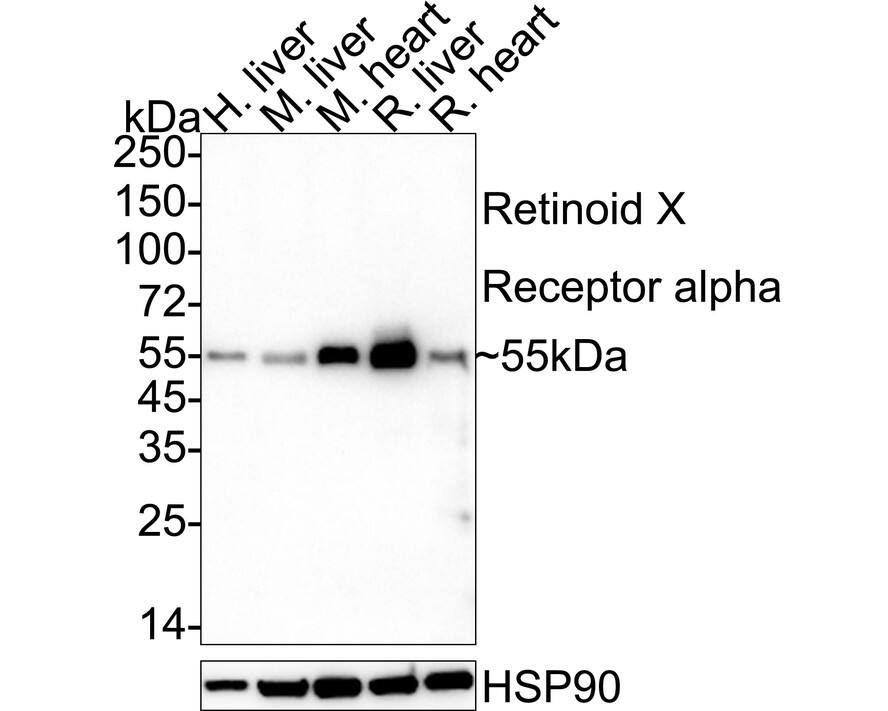 Western blot analysis on different lysates with NBP2-75653 at 1/500 dilution. Lane 1: Human liver tissue lysate Lane 2: Mouse liver tissue lysate Lane 3: Mouse heart tissue lysate Lane 4: Rat liver tissue lysate Lane 5: Rat heart tissue lysate Lysates/proteins at 40 µg/Lane. Predicted band size: 51 kDa Observed band size: 55 kDa Exposure time: 3 minutes;  4-20% SDS-PAGE gel. Proteins were transferred to a PVDF membrane and blocked with 5% NFDM/TBST for 1 hour at room temperature. NBP2-75653 at 1/500 dilution was used in 5% NFDM/TBST at 4℃ overnight. Goat Anti-Rabbit IgG [HRP] Secondary Antibody at 1/50,000 dilution was used for 1 hour at room temperature.