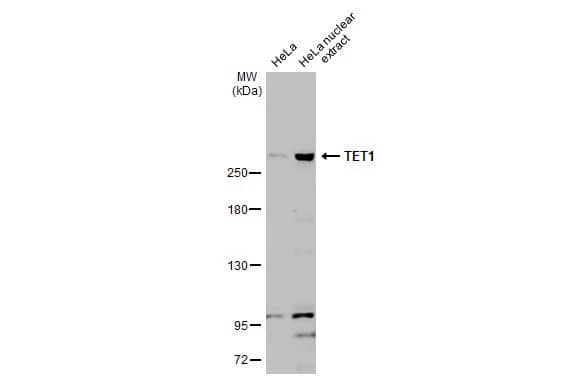 Western Blot: TET1 Antibody [NBP2-76345] - HeLa whole cell and nuclear extracts (30 ug) were separated by 5% SDS-PAGE, and the membrane was blotted with TET1 antibody [N3C1] (NBP2-76345) diluted at 1:1000. The HRP-conjugated anti-rabbit IgG antibody  was used to detect the primary antibody.