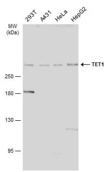 Western Blot: TET1 Antibody [NBP2-76345] - Various whole cell extracts (30 ug) were separated by 5% SDS-PAGE, and the membrane was blotted with TET1 antibody [N3C1] (NBP2-76345) diluted at 1:2000. The HRP-conjugated anti-rabbit IgG antibody  was used to detect the primary antibody.