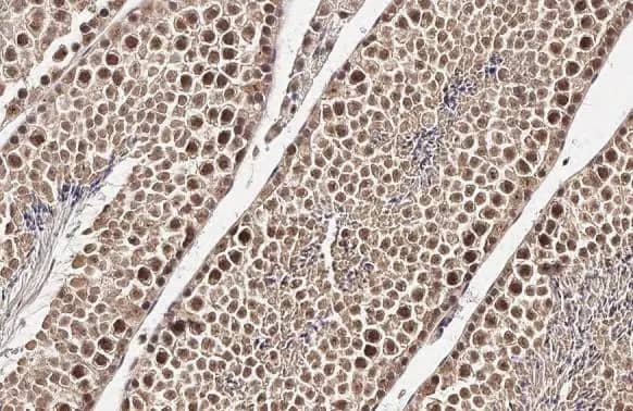 Immunohistochemistry-Paraffin: TET1 Antibody [NBP2-76345] - TET1 antibody [N3C1] detects TET1 protein at nucleus by immunohistochemical analysis.Sample: Paraffin-embedded mouse testis.TET1 stained by TET1 antibody [N3C1] (NBP2-76345) diluted at 1:500.Antigen Retrieval: Citrate buffer, pH 6.0, 15 min