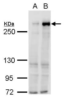 Western Blot: TET1 Antibody [NBP2-76345] - TET1 antibody [N3C1] detects TET1 protein by western blot analysis.A. 30 ug 293T whole cell lysate/extractB. 30 ug whole cell lysate/extract of DDDDK-human TET1-transfected 293T cells5% SDS-PAGETET1 antibody [N3C1] (NBP2-76345) dilution: 1:5000 The HRP-conjugated anti-rabbit IgG antibody  was used to detect the primary antibody.