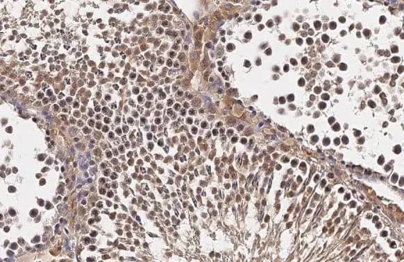 Immunohistochemistry-Paraffin: TET1 Antibody [NBP2-76345] - TET1 antibody [N3C1] detects TET1 protein at nucleus by immunohistochemical analysis.Sample: Paraffin-embedded rat testis.TET1 stained by TET1 antibody [N3C1] (NBP2-76345) diluted at 1:500.Antigen Retrieval: Citrate buffer, pH 6.0, 15 min