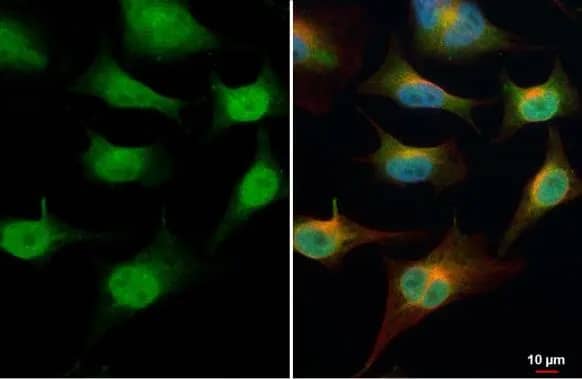 Immunocytochemistry/ Immunofluorescence: TET1 Antibody [NBP2-76345] - TET1 antibody [N3C1] detects TET1 protein at cytoplasm and nucleus by immunofluorescent analysis.Sample: HeLa cells were fixed in 4% paraformaldehyde at RT for 15 min.Green: TET1 stained by TET1 antibody [N3C1] (NBP2-76345) diluted at 1:500.Red: alpha Tubulin, a cytoskeleton marker, stained by alpha Tubulin antibody [GT114]  diluted at 1:1000.Blue: Fluoroshield with DAPI .