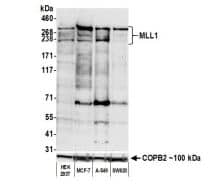 Western Blot: KMT2A/MLL Antibody (BL-175-7E8) [NBP2-76397] -Whole cell lysate (50 ug) from HEK293T, MCF-7, A-549, and SW620 cells prepared using NETN lysis buffer. Antibody: Rabbit anti-MLL1 recombinant monoclonal antibody [BL-175-7E8] used at 1:1000. Secondary: HRP-conjugated goat anti-rabbit IgG. Chemiluminescence with an exposure time of 75 seconds. Lower Panel: Rabbit anti-COPB2 antibody. 