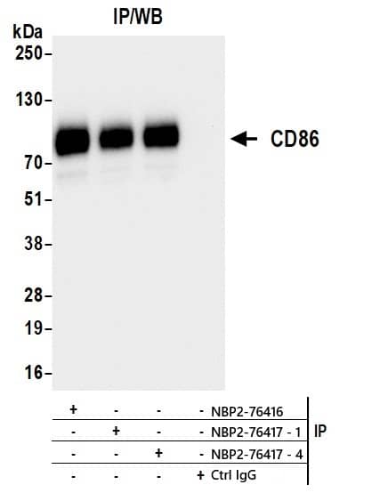 Immunoprecipitation: B7-2/CD86 Antibody (BLR029F) [NBP2-76416] - Samples: Whole cell lysate (1 mg per IP; 10% of IP loaded) from HDLM-2 cells prepared using NETN lysis buffer. Antibodies: NBP2-76417 Lot 4 used for immunoprecipitation at 6 ul per reaction. B7-2/CD86 was also immunoprecipitated by a previous lot of this antibody (NBP2-76417 Lot 1) and a second antibody, NBP2-76416, against a different epitope of B7-2/CD86 (BLR029F). For blotting immunoprecipitated CD86, NBP2-76417 was used at 1:1000. Detection: Chemiluminescence with an exposure time of 1 second.