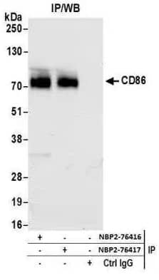 Immunoprecipitation: B7-2/CD86 Antibody (BLR030F) [NBP2-76417] - Detection of human CD86 by WB of immunoprecipitates from HDML-2 lysate. Antibodies: Rabbit anti-CD86 recombinant monoclonal [BLR030F] (NBP2-76417) and rabbit anti-CD86 recombinant monoclonal [BLR029F] (NBP2-76416).