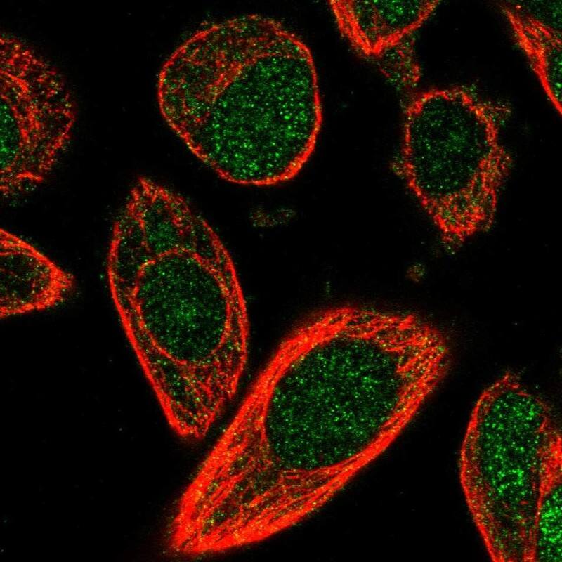 <b>Independent Antibodies Validation. </b>Staining of human cell line PC-3 shows localization to nucleus & cytosol.