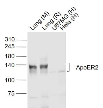 Sample: Lane 1: Lung (Mouse) Lysate at 40 ug Lane 2: Lung (Rat) Lysate at 40 ug Lane 3: U87MG (Human) Lysate at 40 ug Lane 4: Hela (Human) Lysate at 40 ug Primary: NBP2-76911 at 1/1000 dilution Secondary: IRDye800CW Goat Anti-Rabbit IgG at 1/20000 dilution Predicted band size: 170/130 kD Observed band size: 130/125 kD