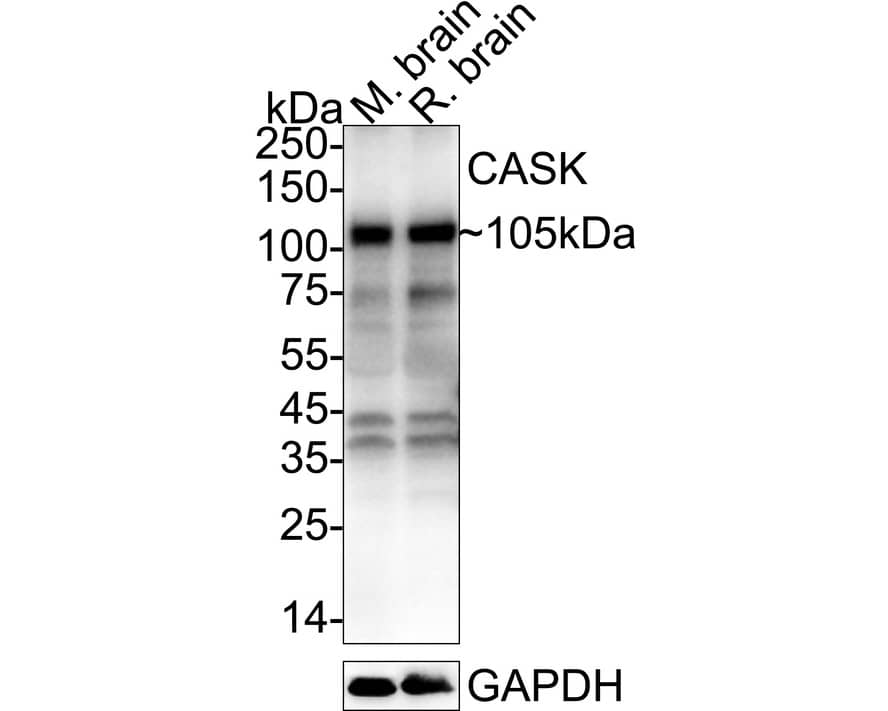Western Blot CASK Antibody
