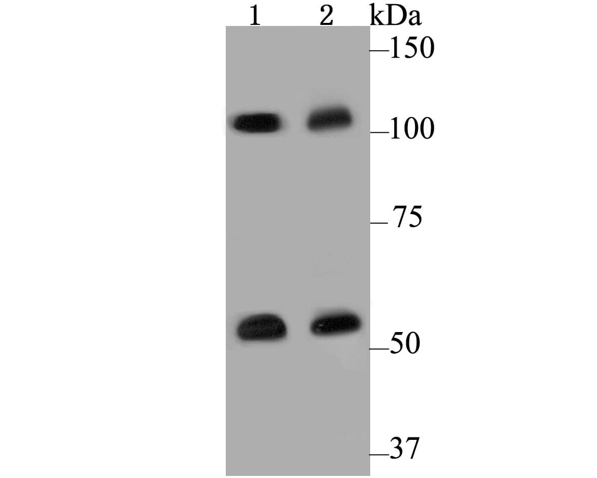 Western Blot CASK Antibody