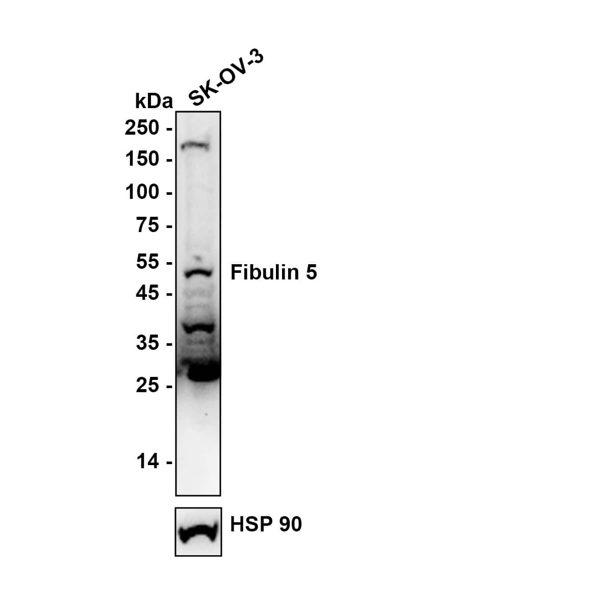 Western blot analysis on different lysates with NBP2-76929 at 1/1,000 dilution. Lane 1: SK-OV-3 (human ovarian cancer cells) cell tissue lysate Lysates/proteins at 20 µg/Lane. Exposure time: 1 minutes Blocking: 5% NFDM/TBST, 1 hour at room temperature Primary antibody: NBP2-76929, 1/1,000 in primary antibody dilution buffer, overnight at 4 ℃ Secondary antibody: Goat Anti-Rabbit IgG [HRP] Secondary Antibody, 1/50,000 in 5% NFDM/TBST, 1 hour at room temperature Predicted band size: 50.2 kDa Observed band size: 50 kDa
