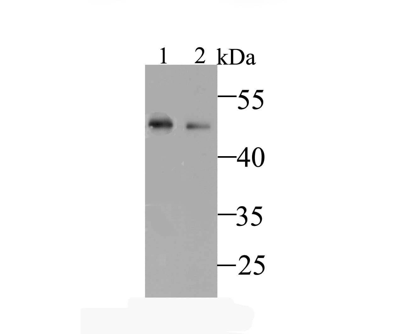 Western blot analysis on different lysates. Proteins were transferred to a PVDF membrane and blocked with NBP2-76944 at room temperature. The primary antibody was used at a 1:500 dilution in 5% BSA at room temperature for 2 hours. Goat Anti-Rabbit IgG [HRP] Secondary Antibody at 1:5,000 dilution was used for 1 hour at room temperature. Positive control: Lane 1: Human liver tissue lysate Lane 2: Mouse liver tissue lysate