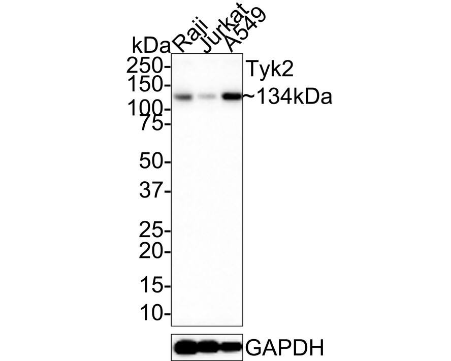 Western blot analysis on different lysates with NBP2-76968 at 1/1,000 dilution. Lane 1: Raji cell lysate Lane 2: Jurkat cell lysate Lane 3: A549 cell lysate Lysates/proteins at 20 µg/Lane. Predicted band size: 134 kDa Observed band size: 134 kDa Exposure time: 1 minute; 4-20% SDS-PAGE gel. Proteins were transferred to a PVDF membrane and blocked with 5% NFDM/TBST for 1 hour at room temperature. NBP2-76968 at 1/1,000 dilution was used in 5% NFDM/TBST at room temperature for 2 hours. Goat Anti-Rabbit IgG [HRP] Secondary Antibody at 1:100,000 dilution was used for 1 hour at room temperature.