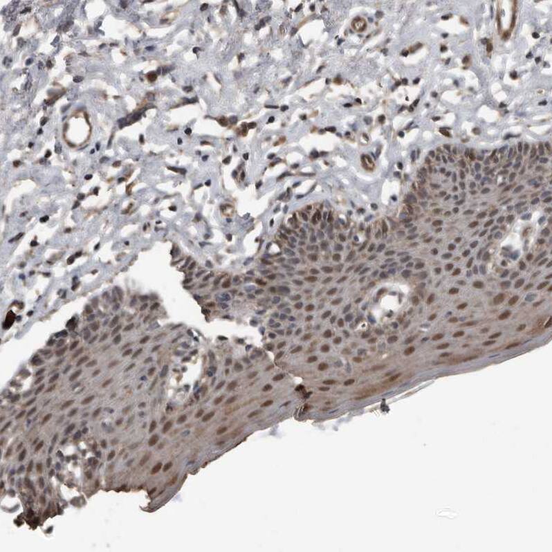 Staining of human skin shows moderate nuclear positivity in squamous epithelial cells.