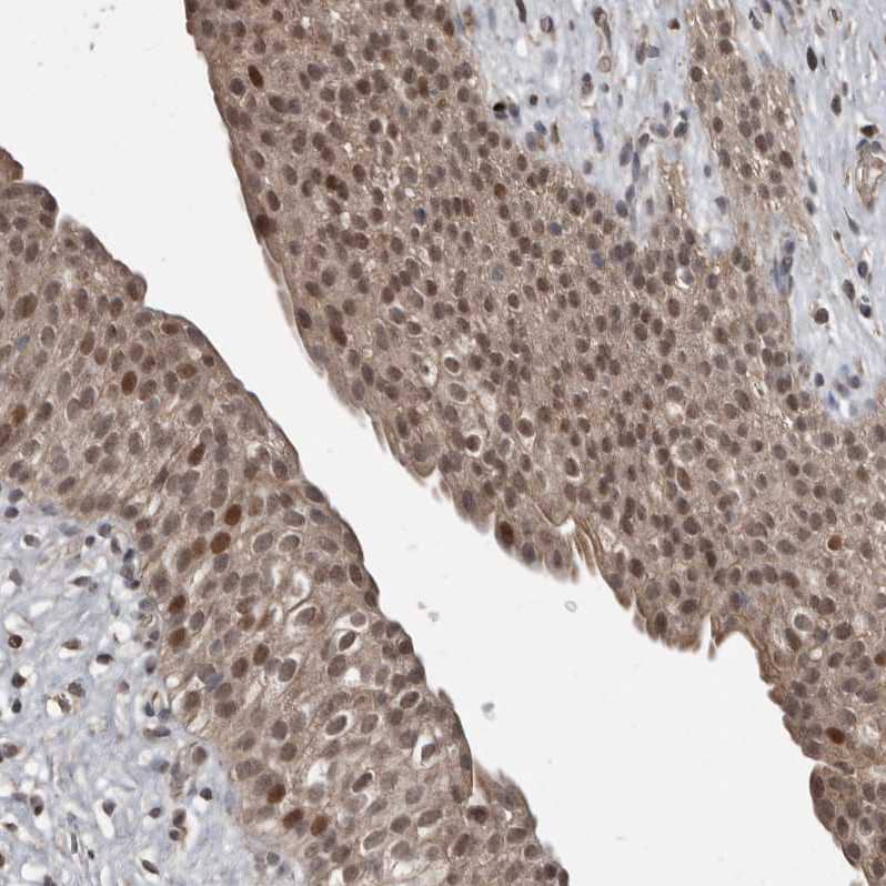 Staining of human urinary bladder shows strong nuclear positivity in urothelial cells.
