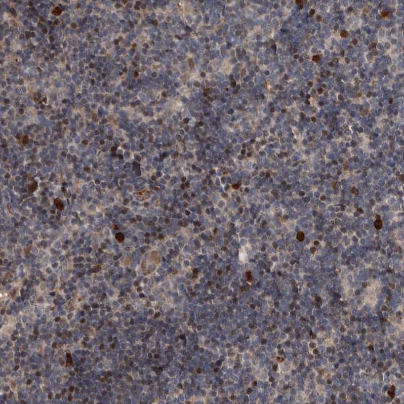Staining of human lymph node shows strong nuclear positivity in subset of non-germinal center cells.