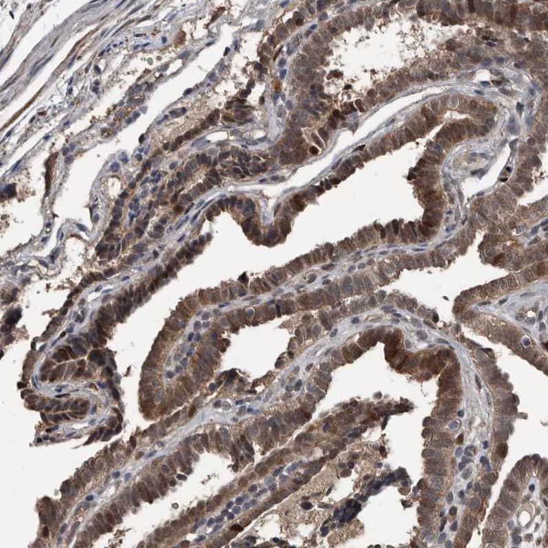 Staining of human fallopian tube shows moderate nuclear and cytoplasmic positivity in glandular cells.