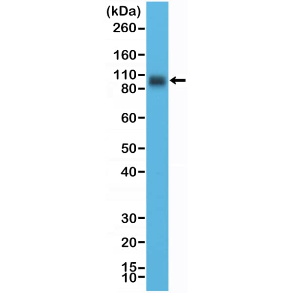 Western Blot: B7-H3/CD276 Antibody (RM335) [NBP2-77415] - Western Blot of LNCaP cell lysate using Clone RM335 at a 1:10000 dilution.