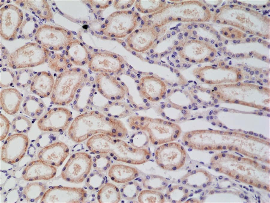 Immunohistochemistry: p120-catenin Antibody (RM353) [NBP2-77423] - Immunohistochemical staining of formalin fixed and paraffin embedded human kidney tissue section using NBP2-77423.