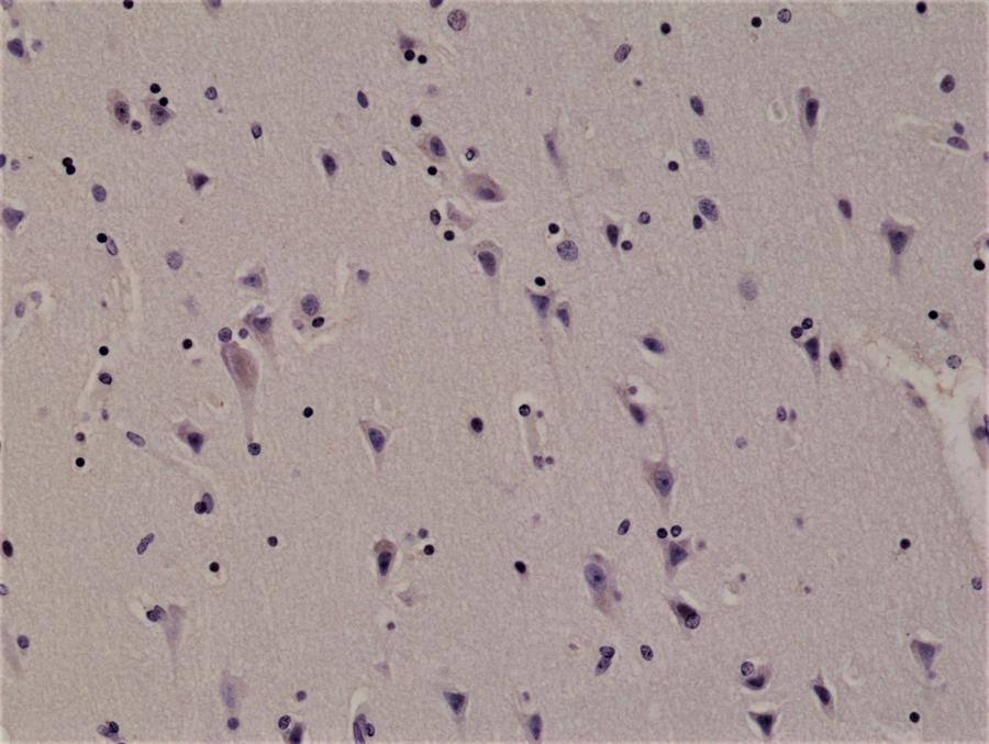 Immunohistochemistry-Paraffin: ALK/CD246 Antibody (RM361) [NBP2-77424] - Immunohistochemical staining of formalin fixed and paraffin embedded human brain tissue section using Clone RM361 at a 1:1000 dilution.