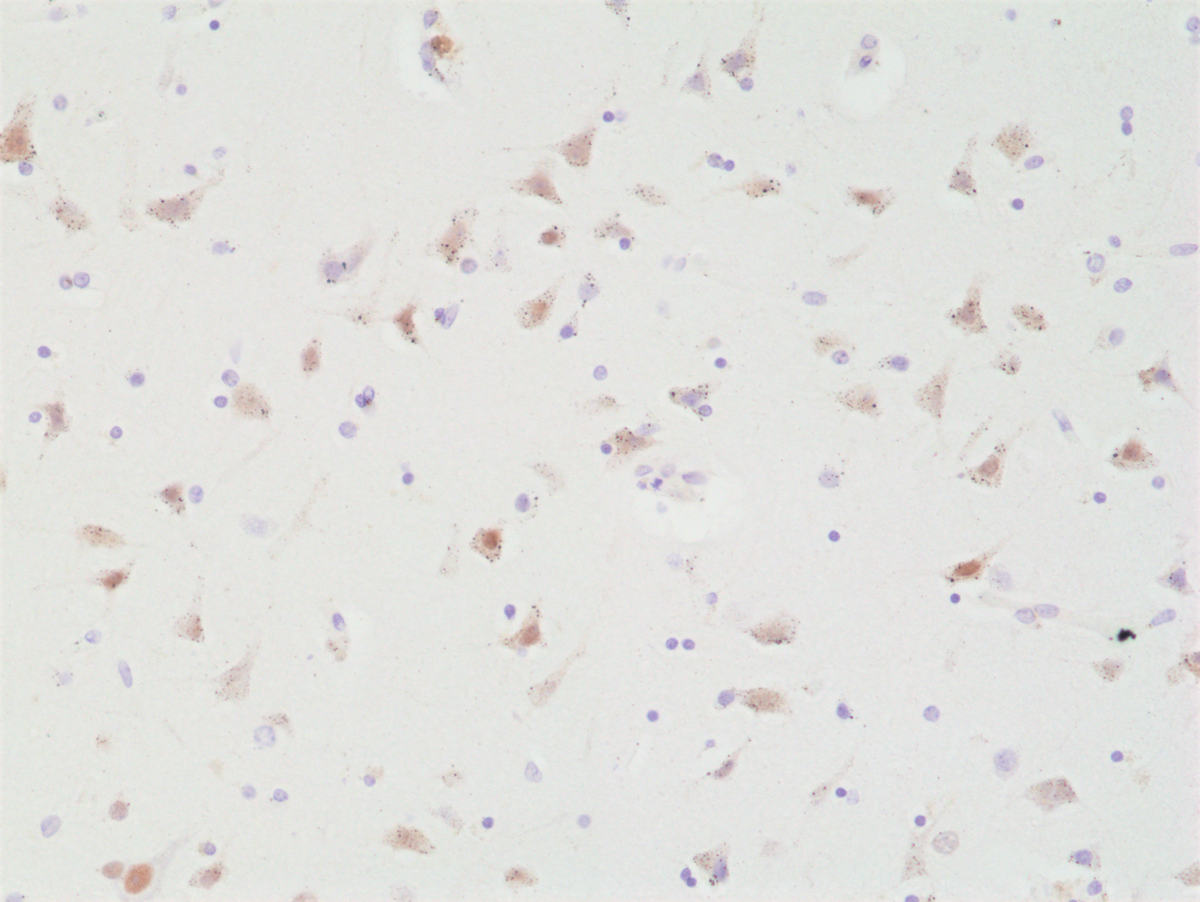 Immunohistochemistry-Paraffin: SATB2 Antibody (RM365) [NBP2-77427] - Immunohistochemical staining of formalin fixed and paraffin embedded human brain tissue section using Clone RM365 at a 1:200 dilution.