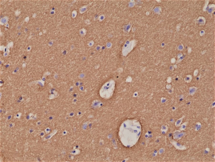 Immunohistochemistry: Syntaxin 1A Antibody (RM367) [NBP2-77428] - Immunohistochemical staining of formalin fixed and paraffin embedded human brain tissue section using RM367